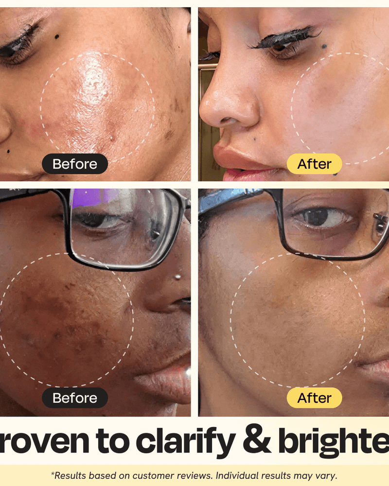 Vitamin C Clay Mask