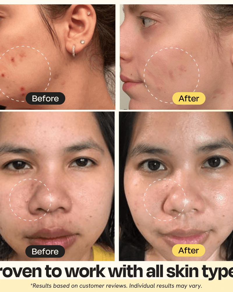 Vitamin C Clay Mask